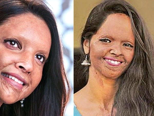 Deepika padukone as acid attack surviour