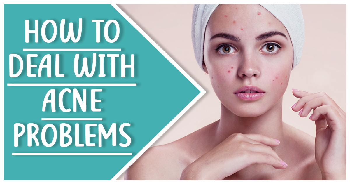 How to deal with acne problems